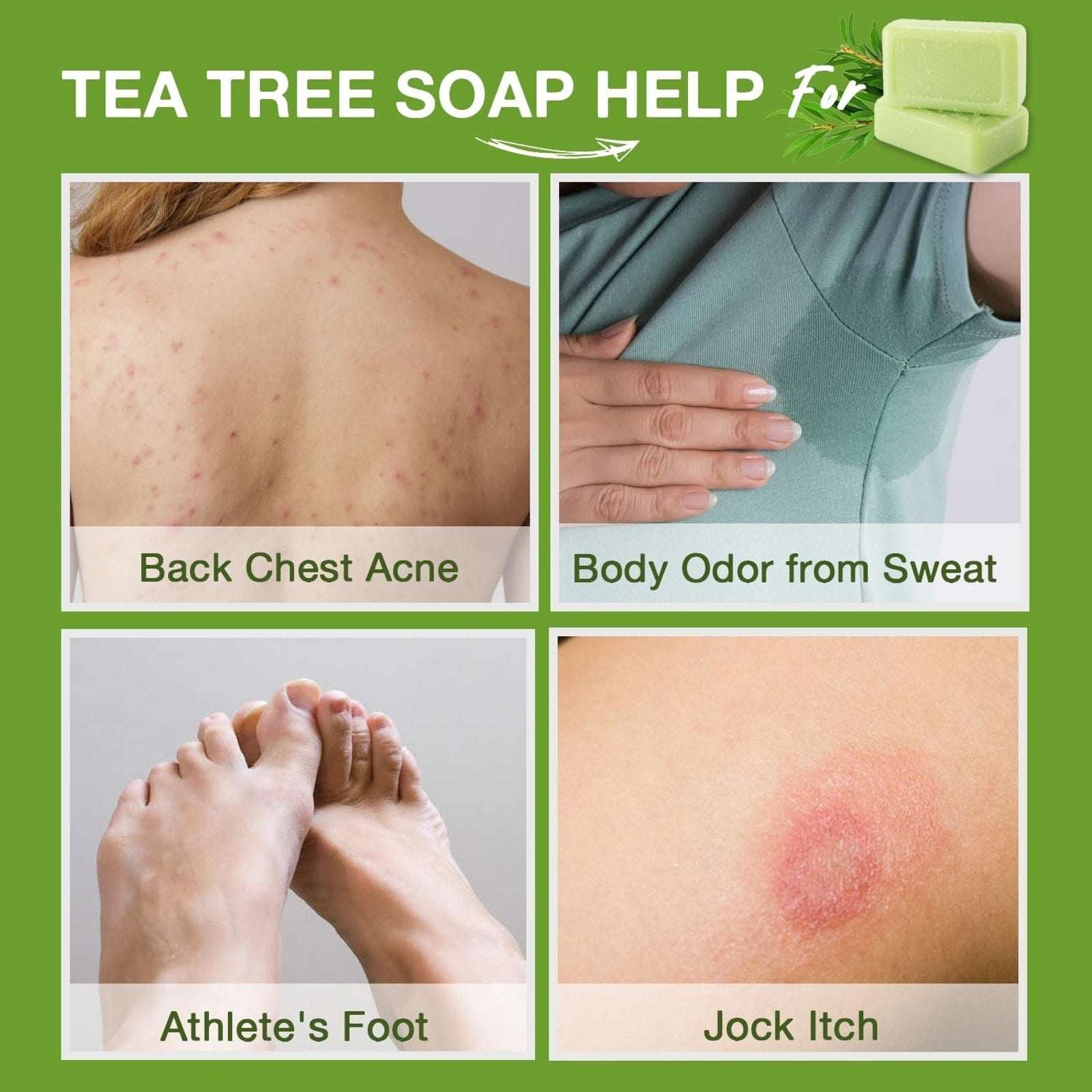 8PK Antifungal Bar Soap Tea Tree Oil for Face & Body Athlete’s Foot, Jock Itch