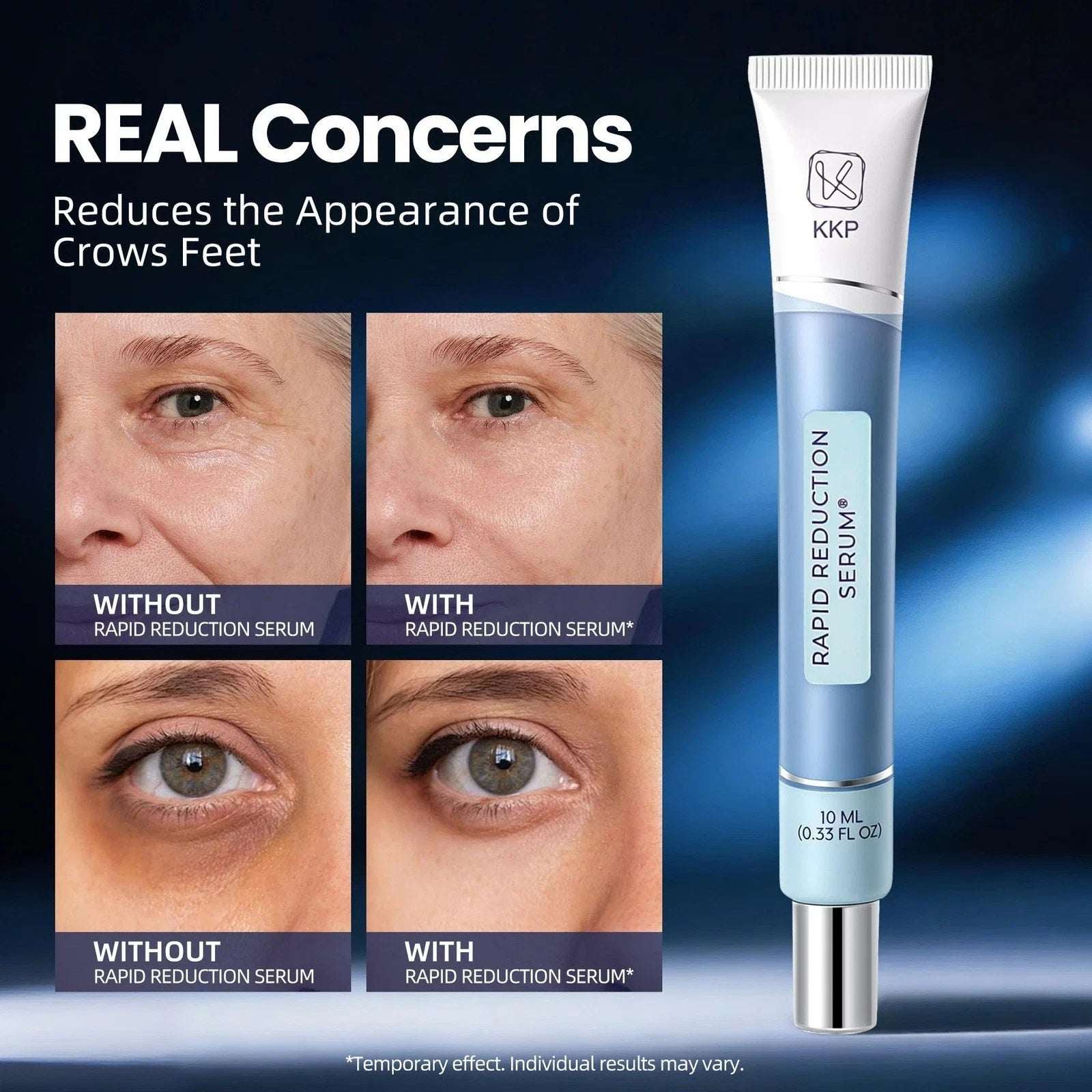 Rapid Reduction Eye Serum Visibly Reduces Under-Eye Bags, Wrinkles, Dark Circles
