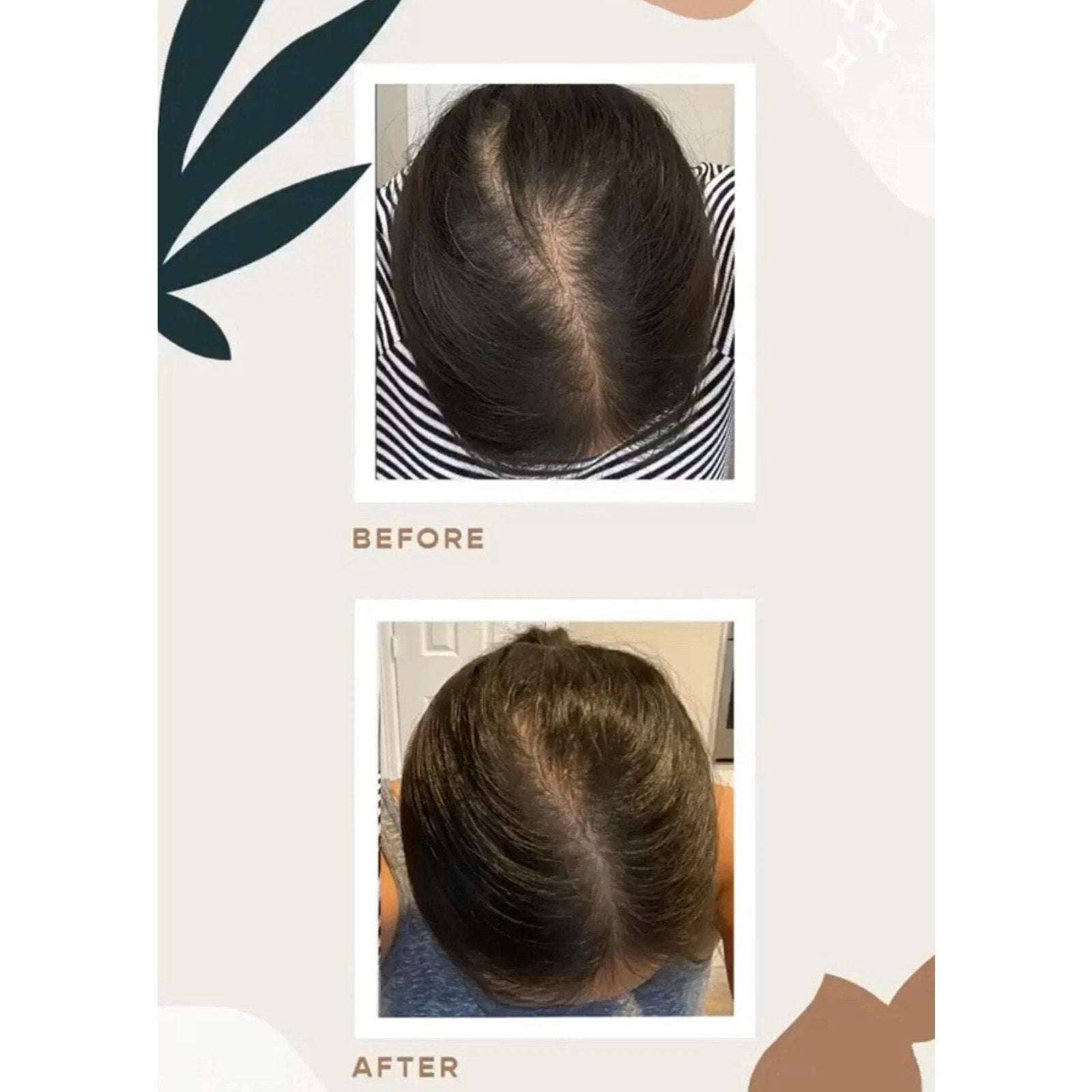 NEW Vegamour GRO Hair Serum for Thinning Hair 30ML / 1floz Fuller Healthier Hair