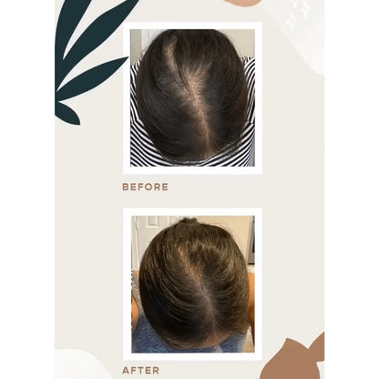 NEW Vegamour GRO Hair Serum for Thinning Hair 30ML / 1floz Fuller Healthier Hair
