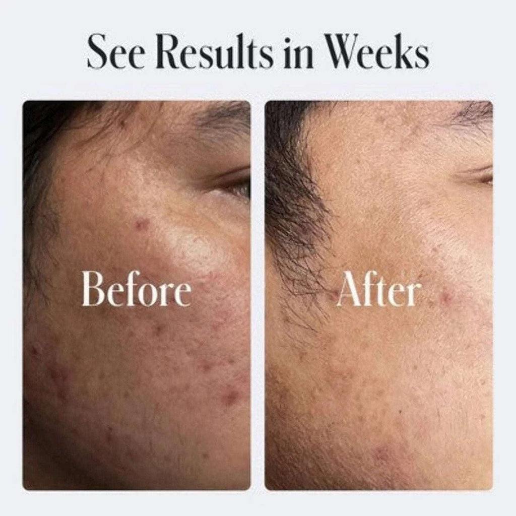 2x Geologie Clear System PM Skin Repair Resurfacing Moisturizer 0.2% Retinol 2oz