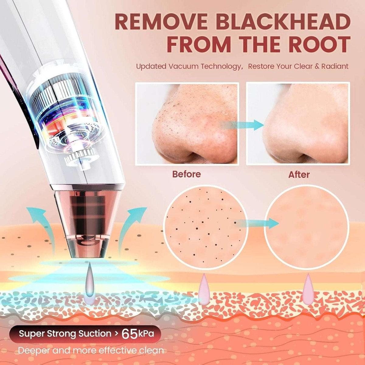 Blackhead Remover Pore Vacuum w/ LED Screen & 4 Probes Tighten, Lift & Exfoliate