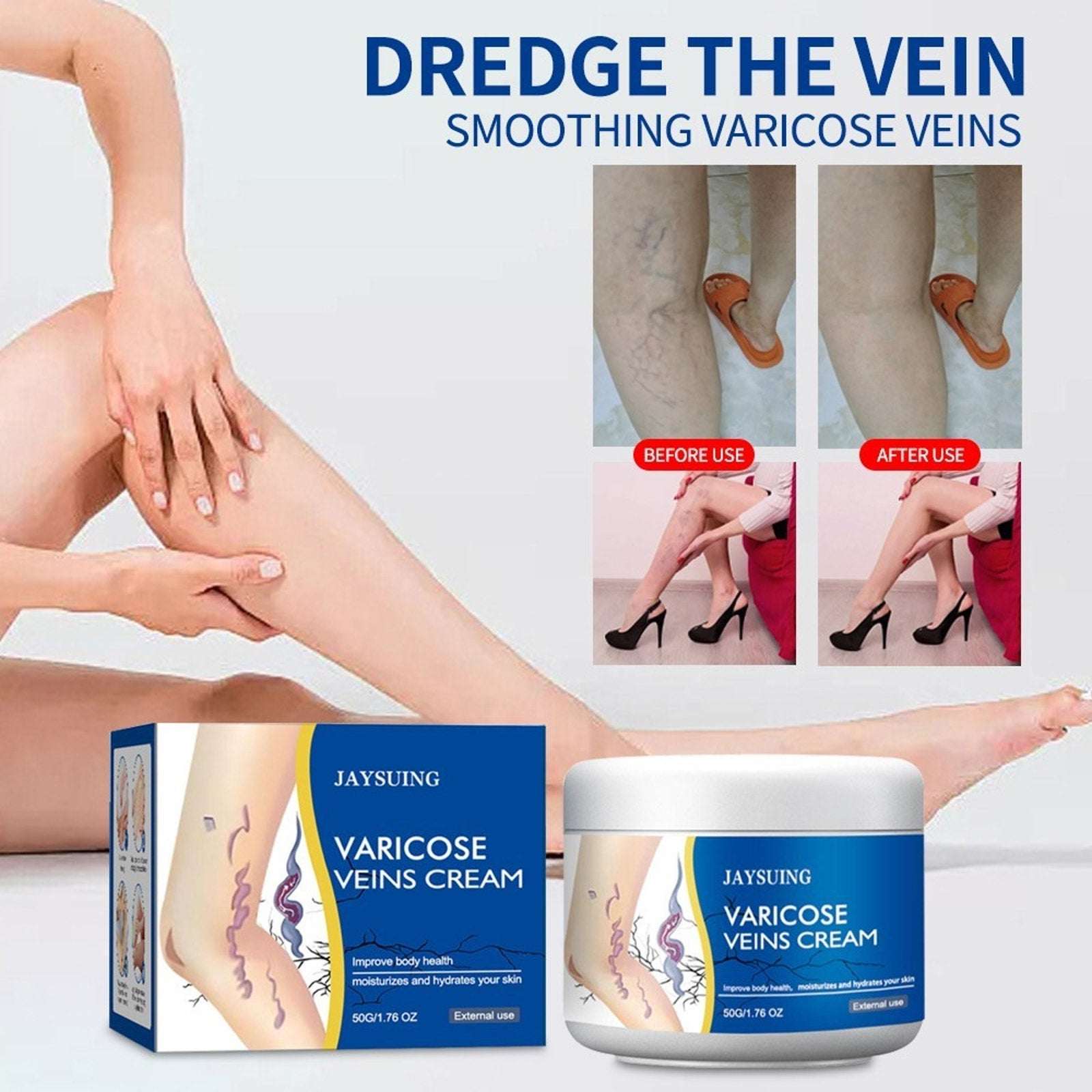 Varicose Veins Cream, Spider Veins Leg Fatigue Repair Cream, 50G/1.76oz