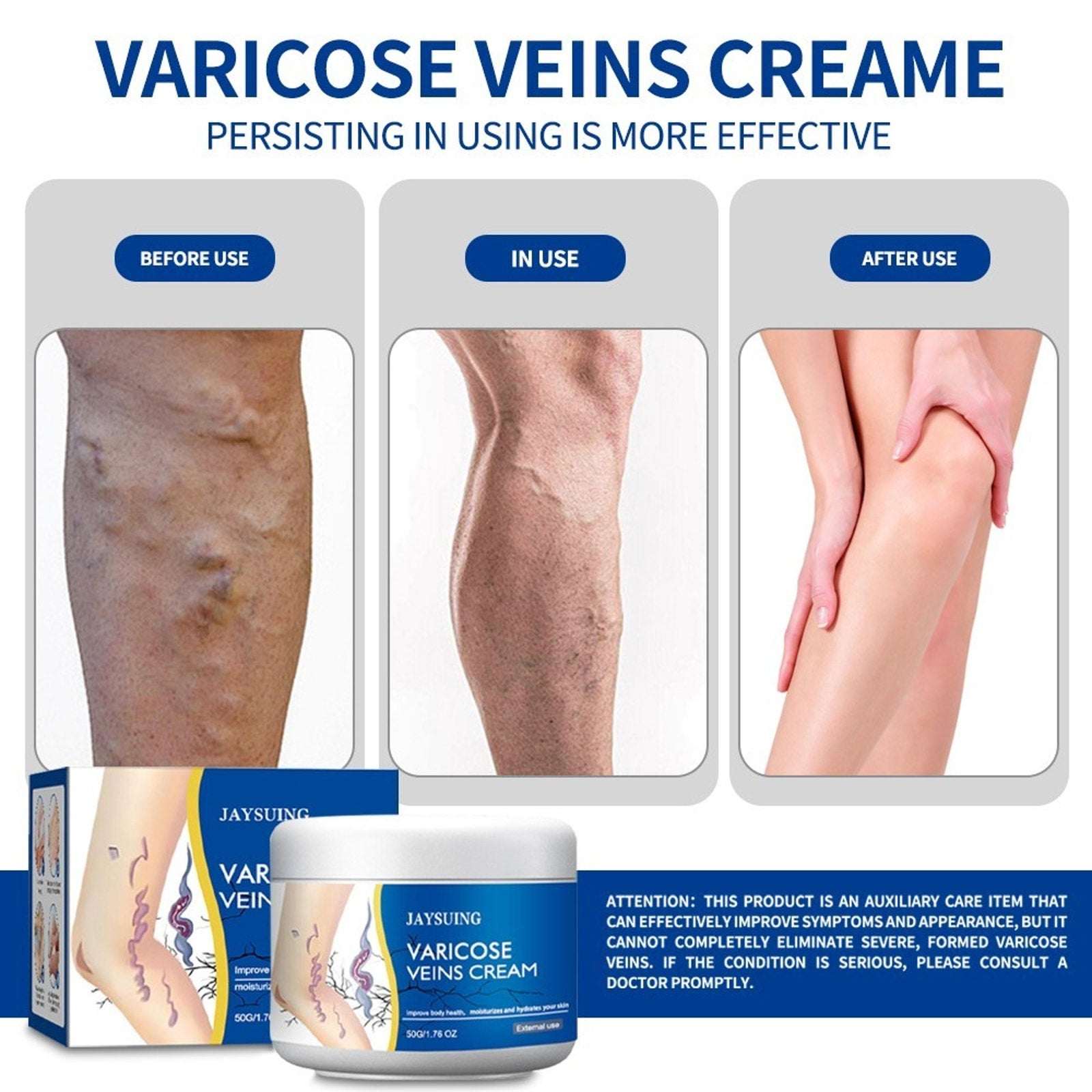 Varicose Veins Cream, Spider Veins Leg Fatigue Repair Cream, 50G/1.76oz