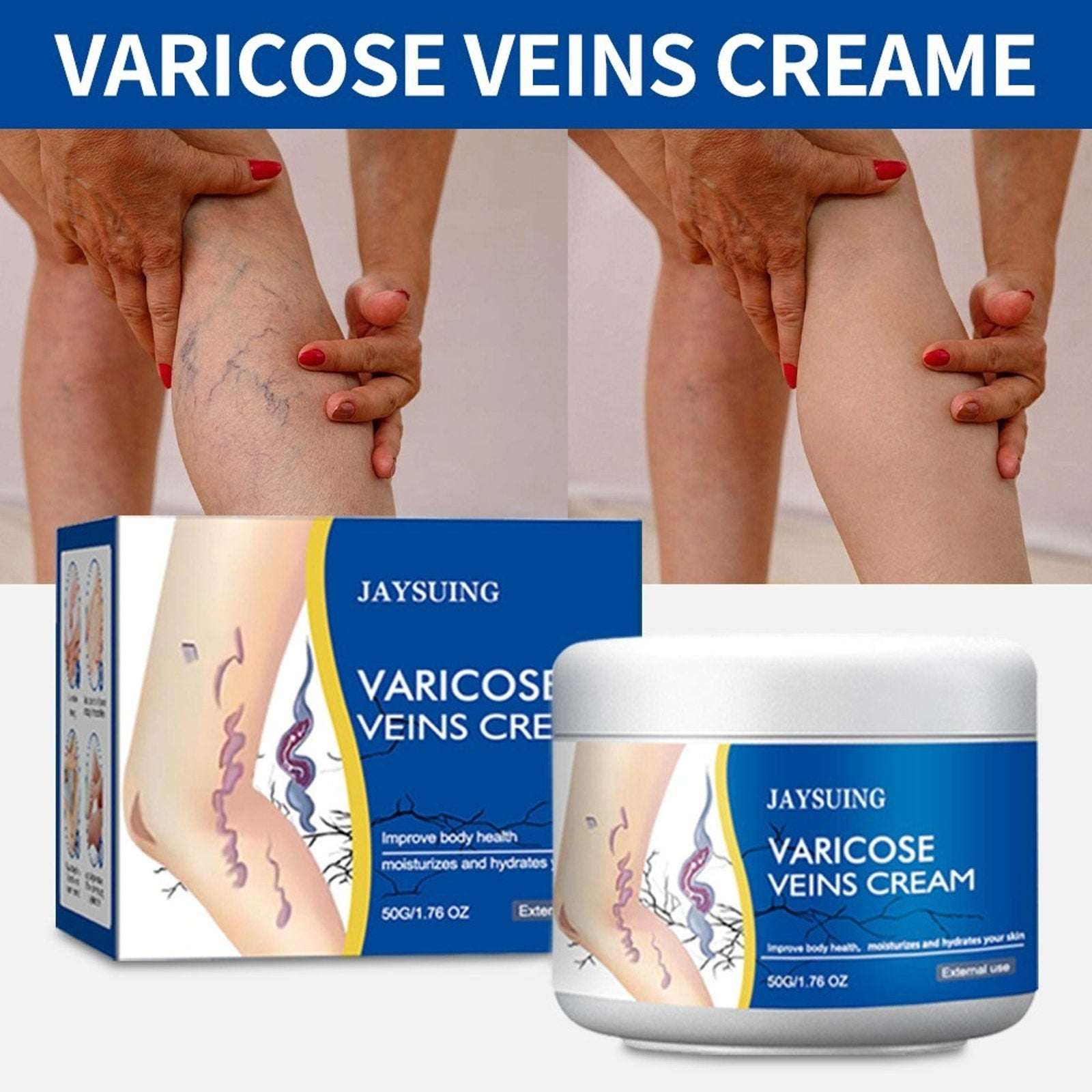 Varicose Veins Cream, Spider Veins Leg Fatigue Repair Cream, 50G/1.76oz