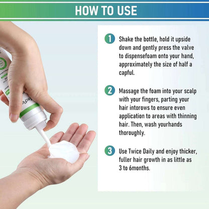 TecFlox 5% Minoxidil Hair Regrowth Foam with Biotin for Men & Women, 6 Months