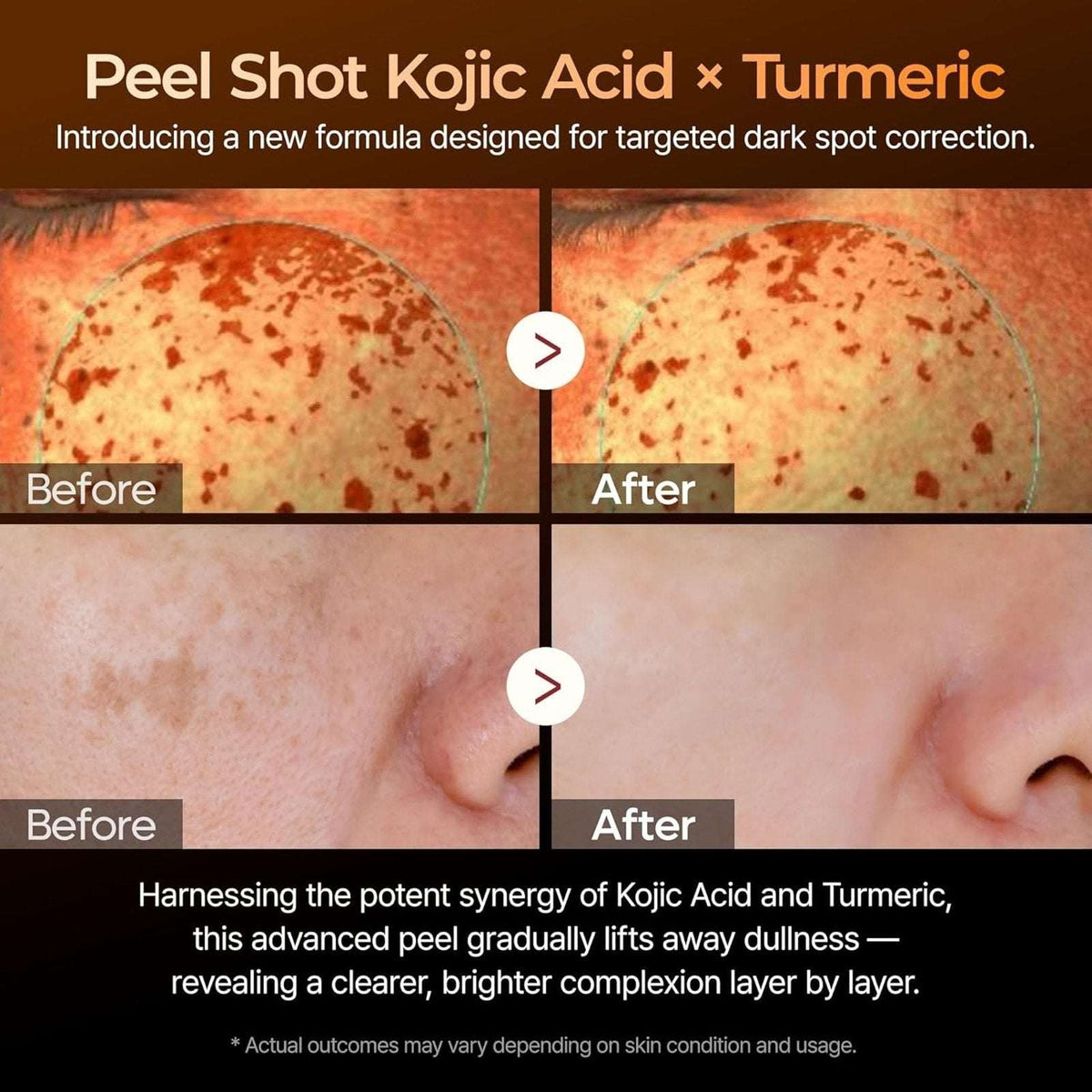 Dr.Melaxin Peel Shot Exfoliating Kojic Acid Turmeric + Glycolic Serum 2.7 fl.oz.
