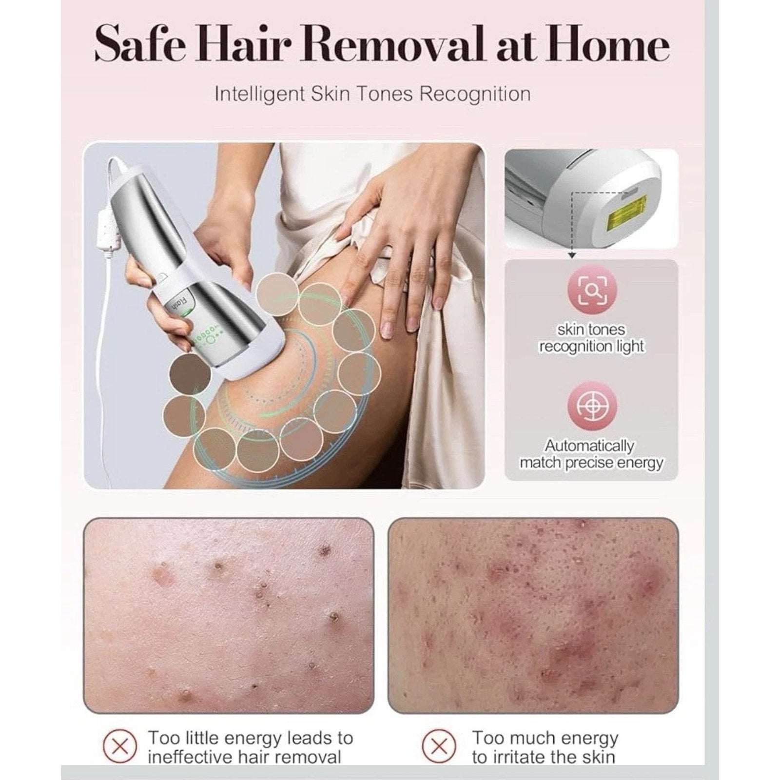 LumiAes IPL Laser Hair Removal Device, Ice-Cooling & Smart Skin Tone Recognition