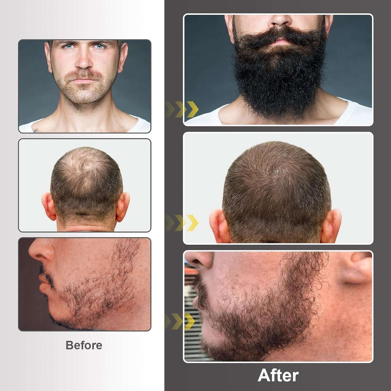 Naland Beard Growth Kit - Growth Oil (2oz), Beard Balm, Beard Comb & Massager