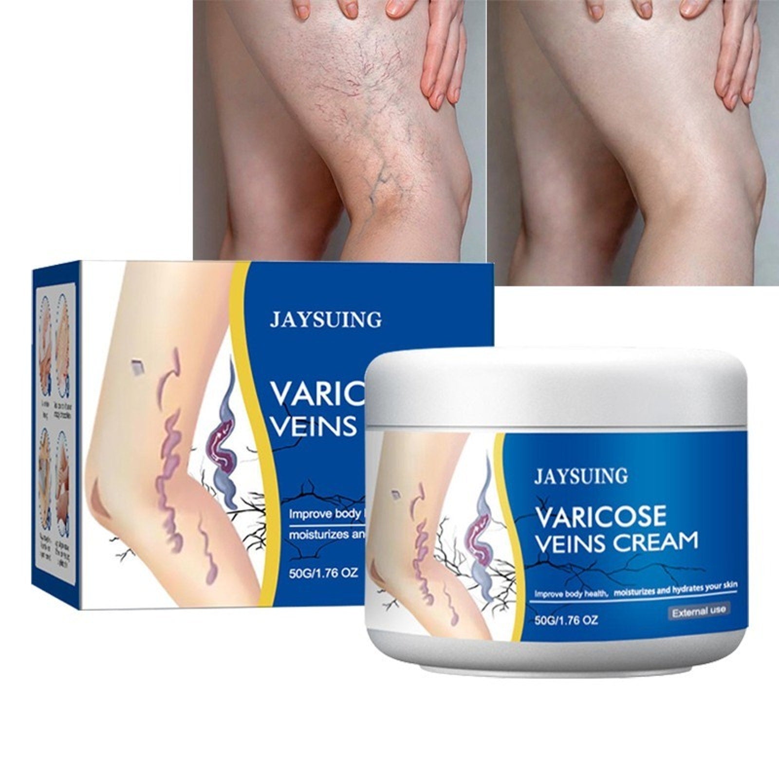 Varicose Veins Cream, Spider Veins Leg Fatigue Repair Cream, 50G/1.76oz