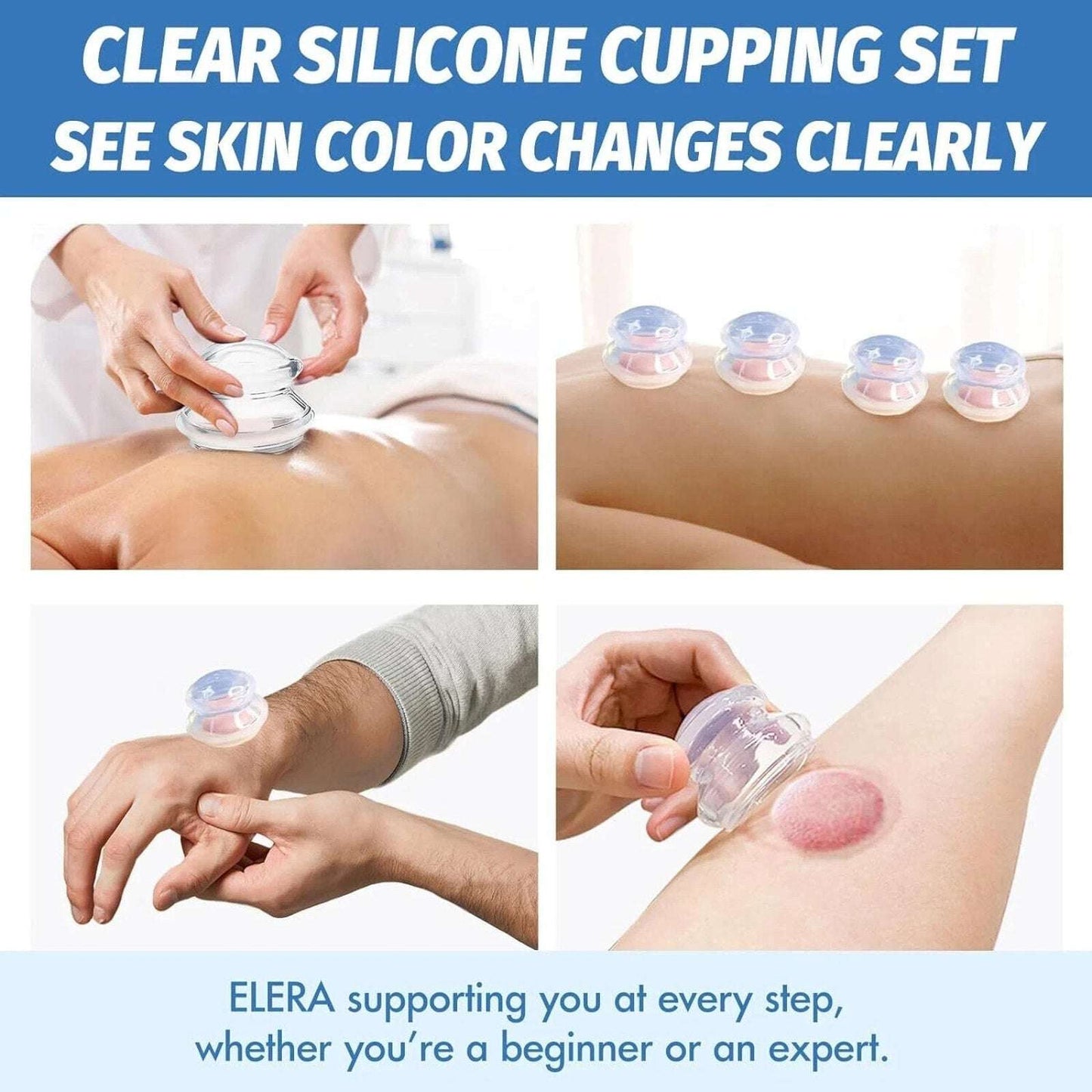 ELERA 7Pc Silicone Cupping Therapy Set, Chinese Massage for Cellulite Reduction