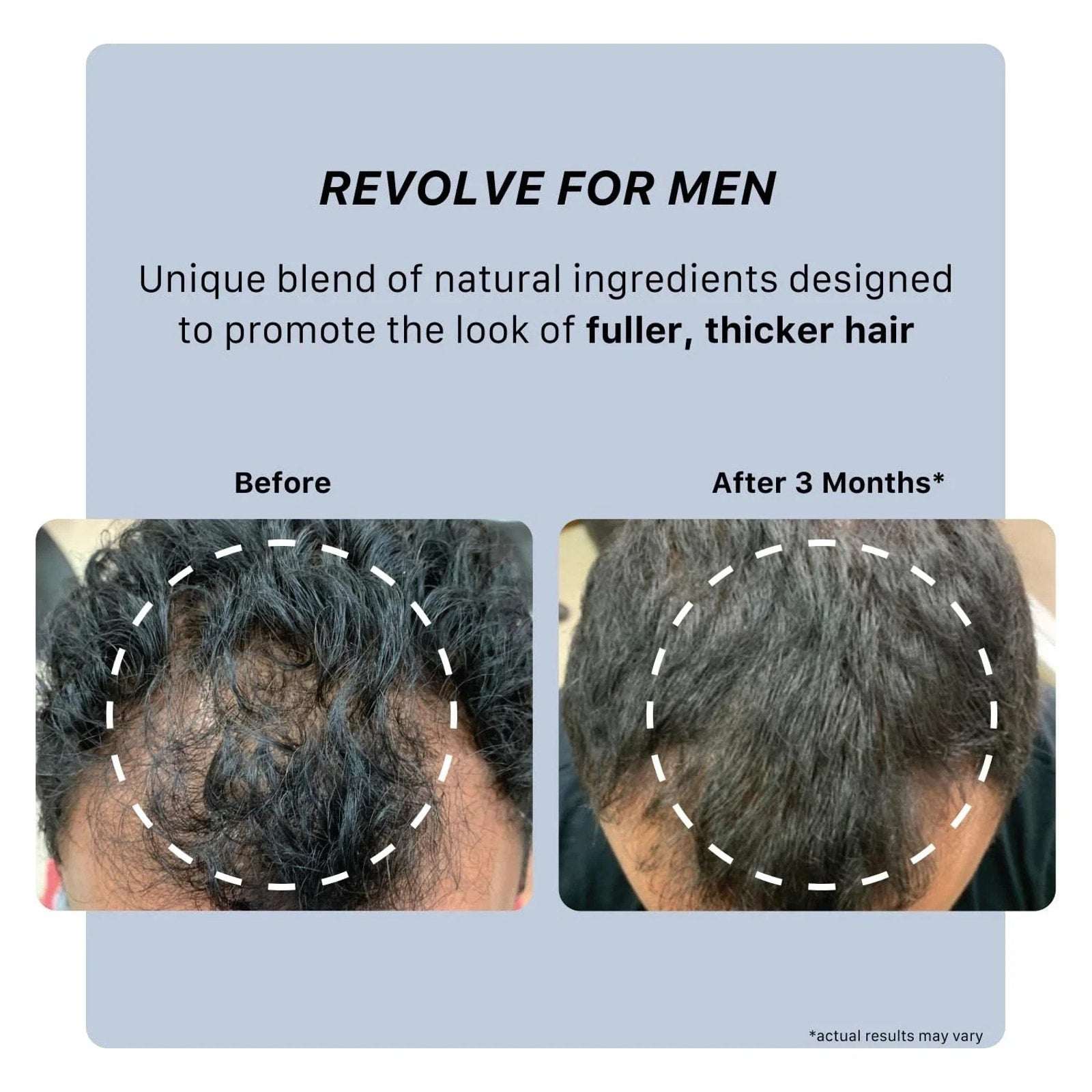 ACTiiV Recover ACT/IV Thickening Shampoo Treatment for Men 2.7 fl oz / 80ML