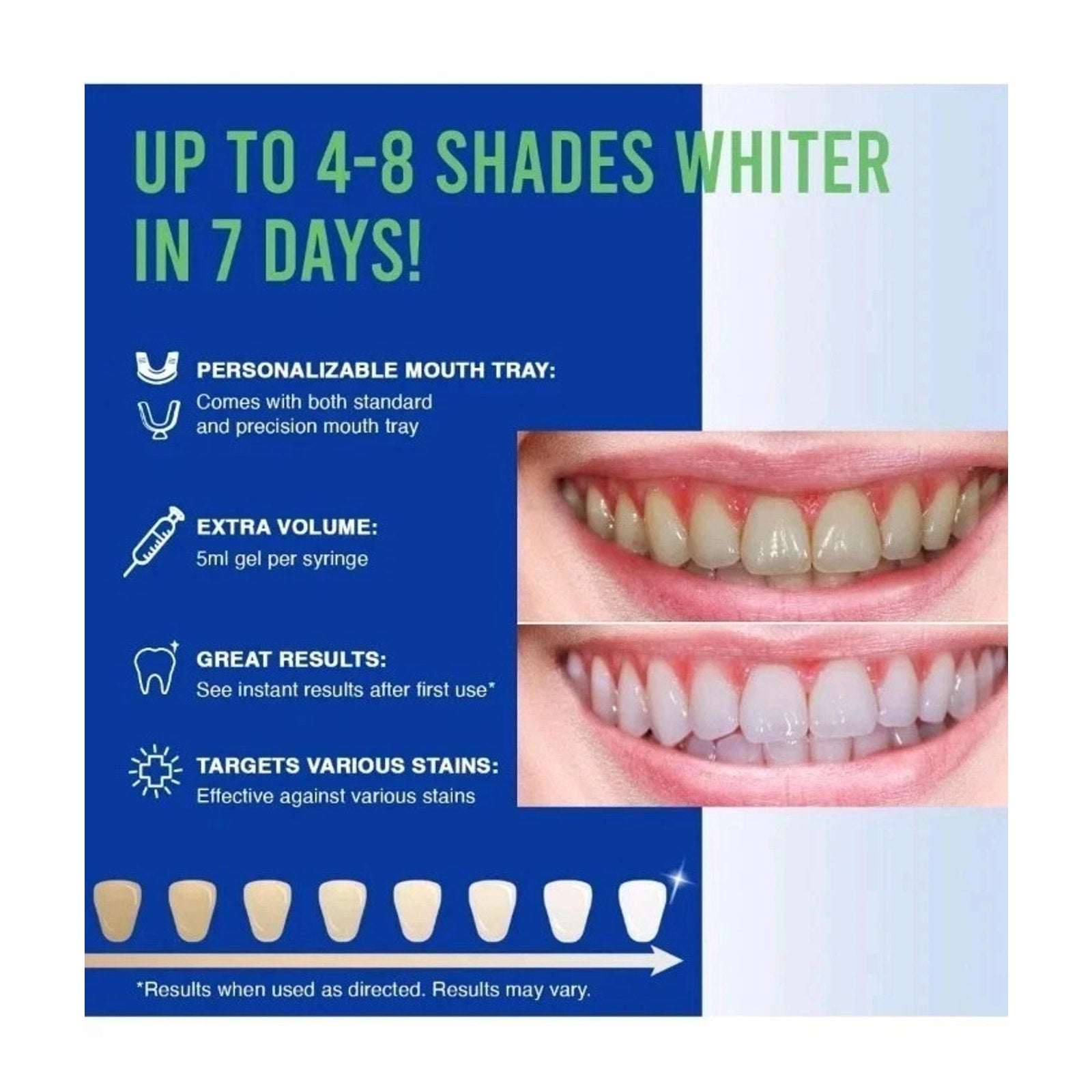 VieBeauti LED Light Activated Teeth Whitening System, Home Dental Whitening, New