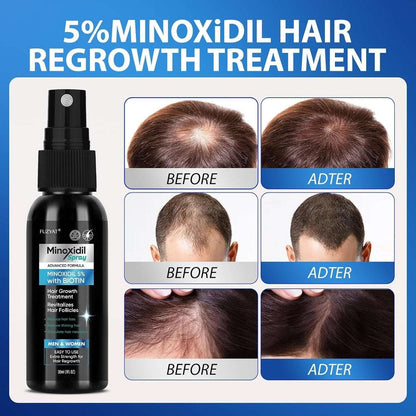 Minoxidil 5% +BIOTIN Advanced Formula Hair Regrowth Treatment 2 x 30ml/1 fl oz