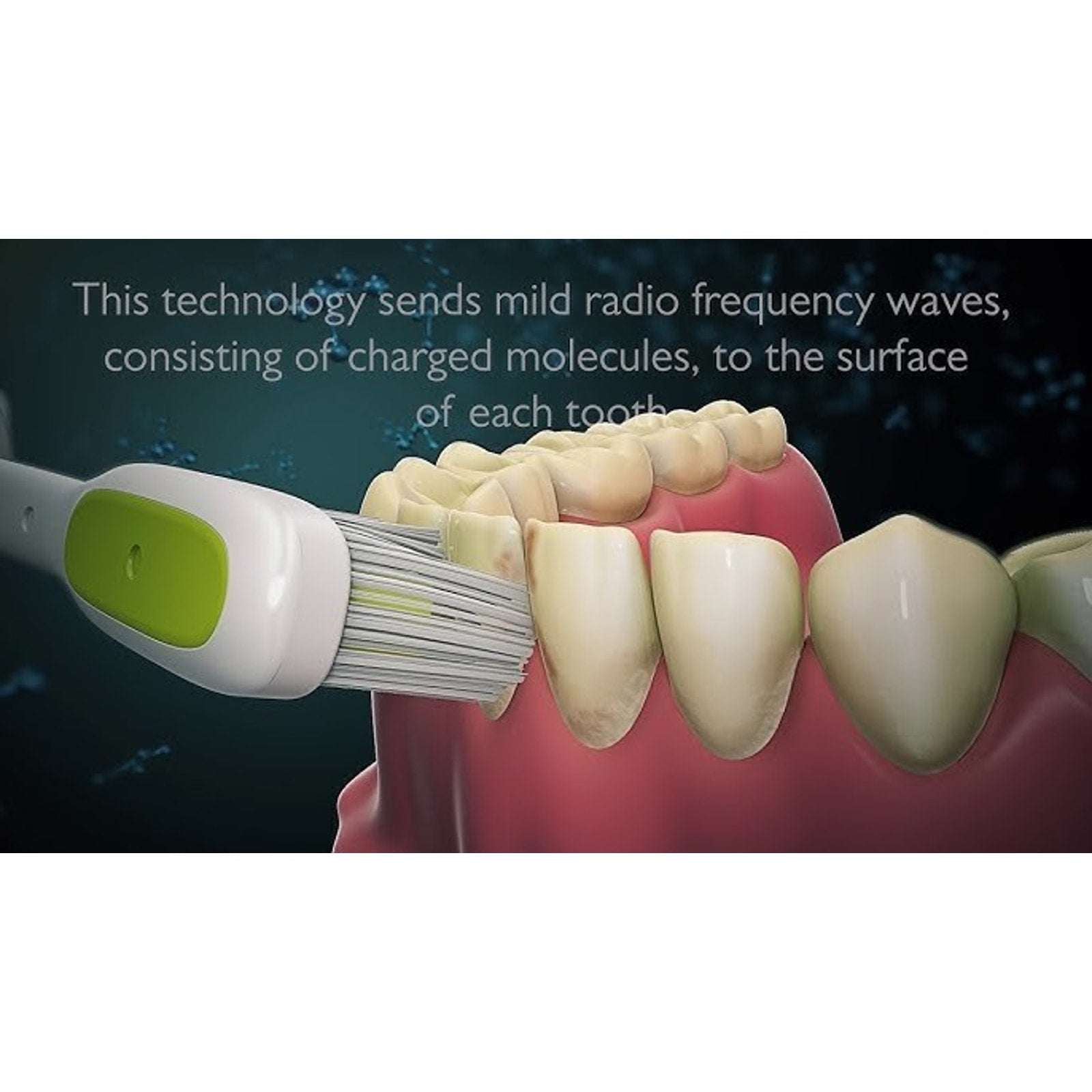 Silk'n ToothWave DentalRF Technology Toothbrush Brand New/Sealed MSRP $349
