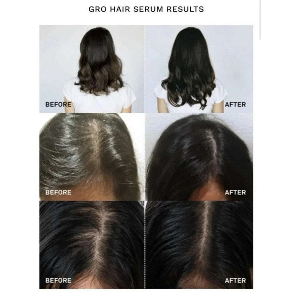 NEW Vegamour GRO Hair Serum for Thinning Hair 30ML / 1floz Fuller Healthier Hair
