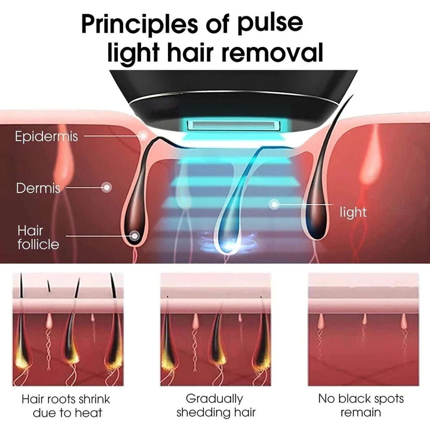 Aimanfun Ice Sense IPL Hair Remover A-3588 - 300K+ Flashes, Cooling, Automatic