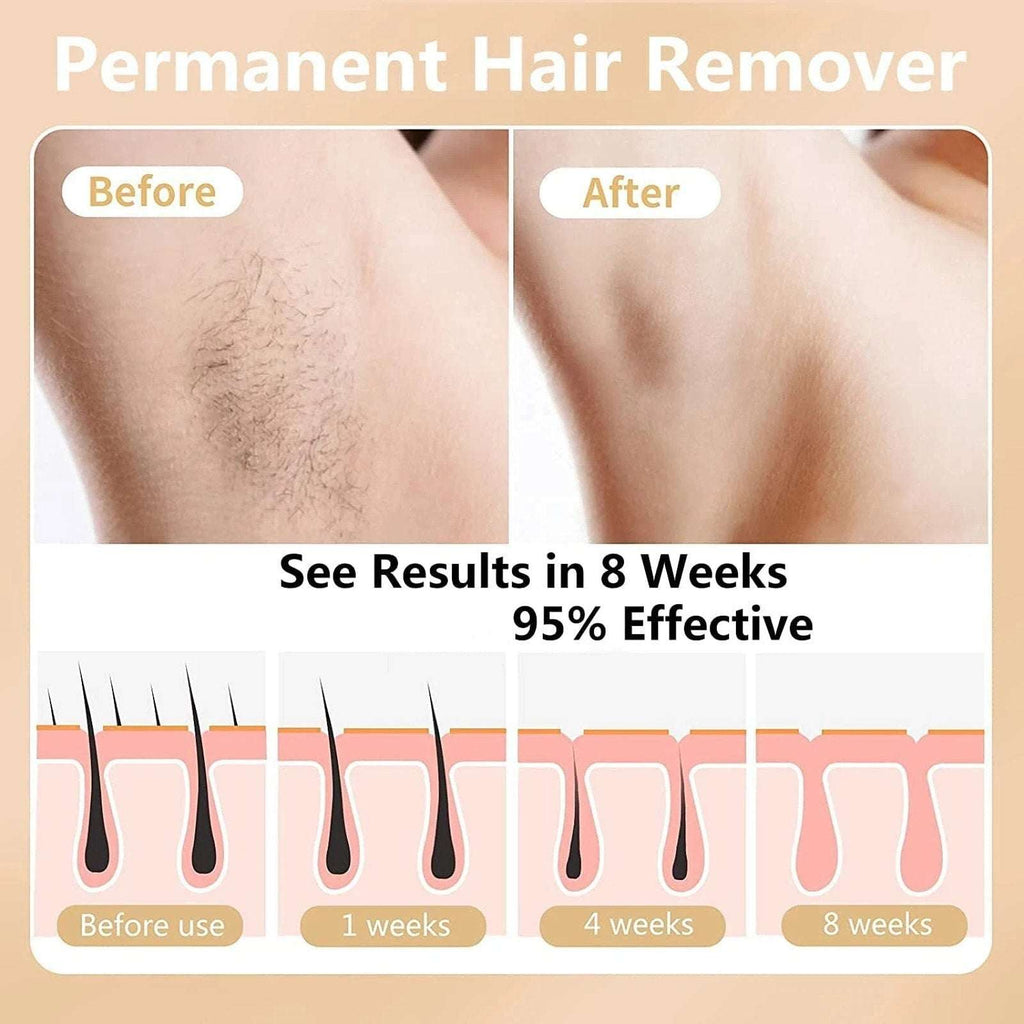 Aimanfun Ice Sense IPL Hair Remover A-3588 - 300K+ Flashes, Cooling, Automatic