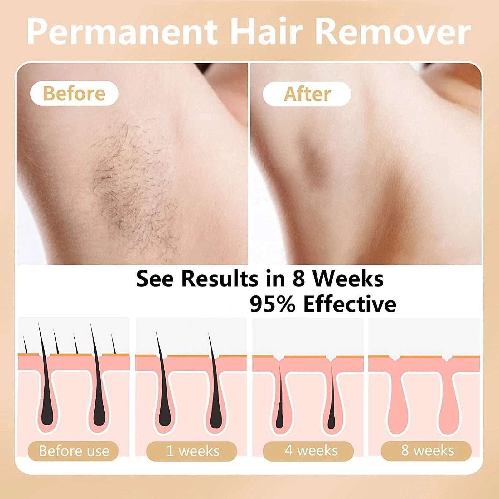 Aimanfun Ice Sense IPL Hair Remover A-3588 - 300K+ Flashes, Cooling, Automatic