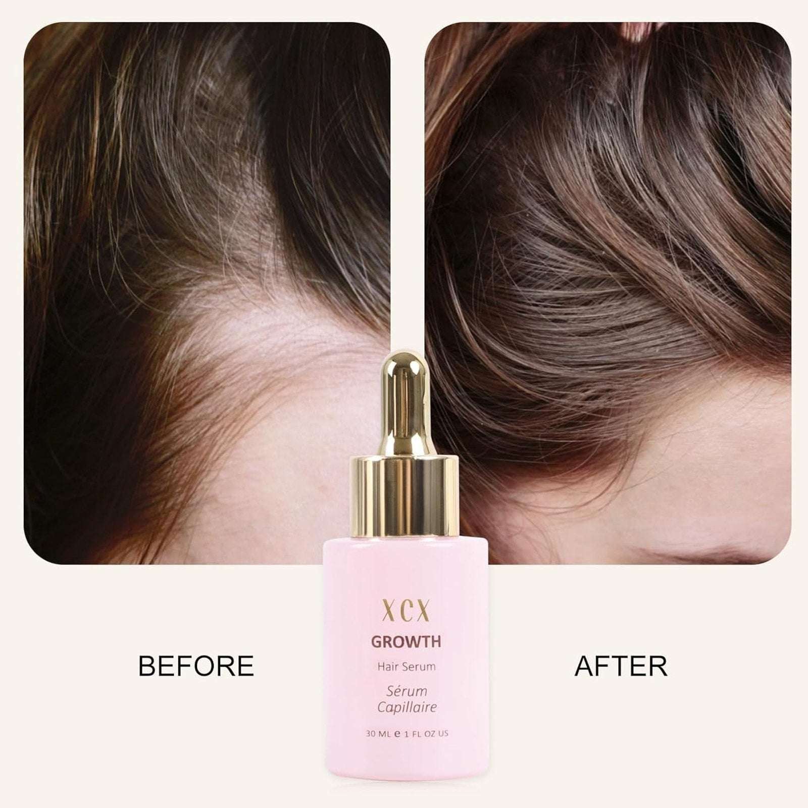 XCX Vegan Hair Growth Serum - Natural Hair Regrowth and Hair Loss Treatment