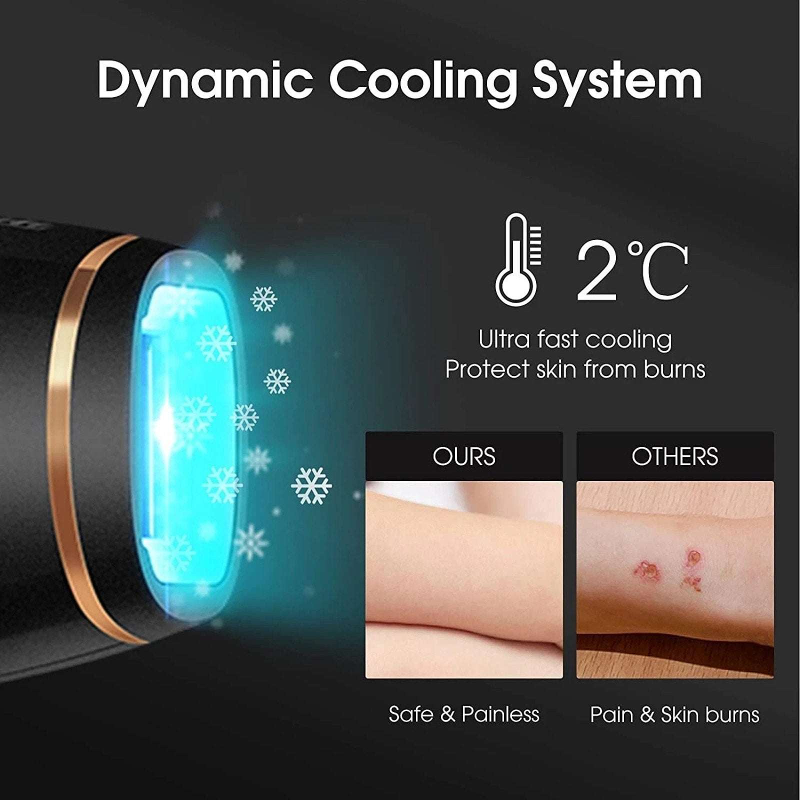 Aimanfun Ice Sense IPL Hair Remover A-3588 - 300K+ Flashes, Cooling, Automatic