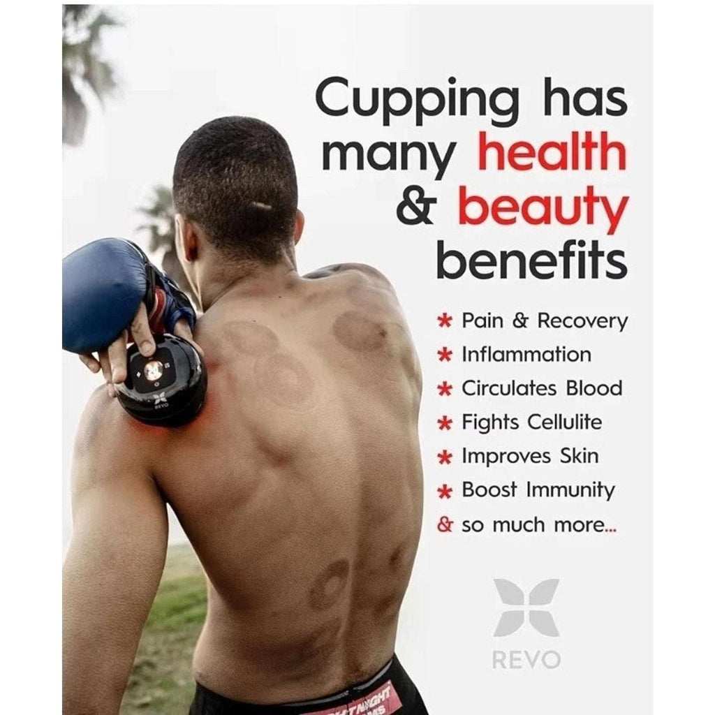 REVO Smart Cup The Original 4-in-1 Red Light Cupping Therapy Massager w Heat NEW