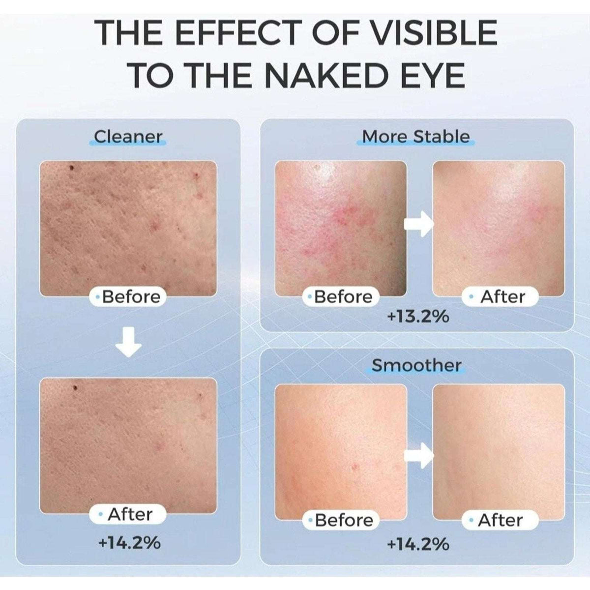 Evfofo Red LED Light Therapy Face Mask 7 Color LED Smoother & More Refined Skin