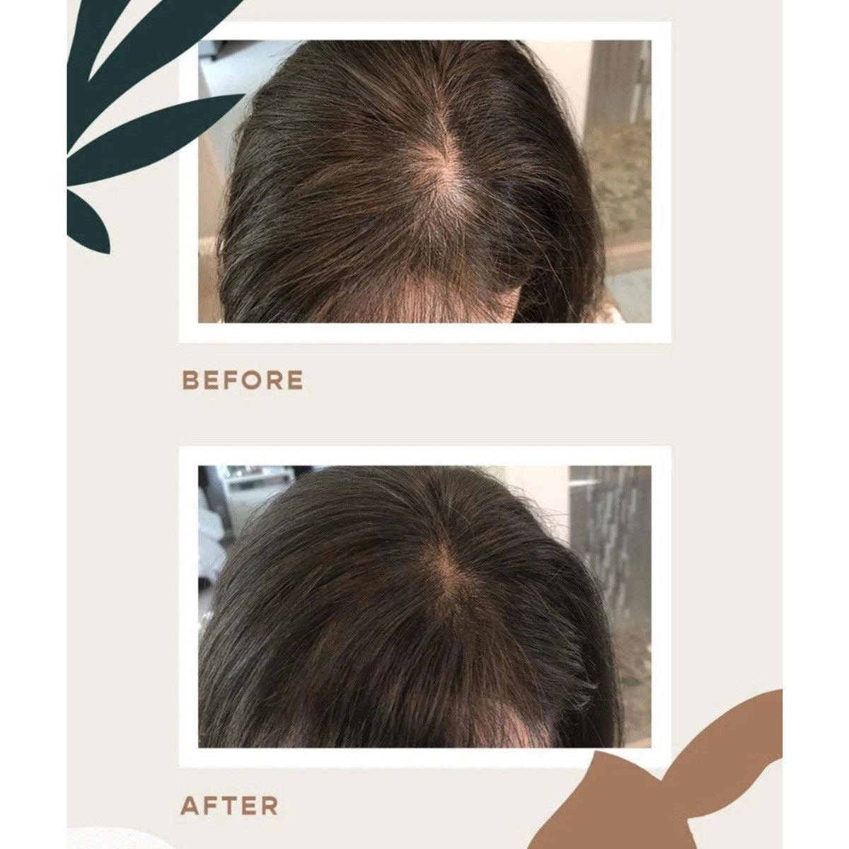 NEW Vegamour GRO Hair Serum for Thinning Hair 30ML / 1floz Fuller Healthier Hair